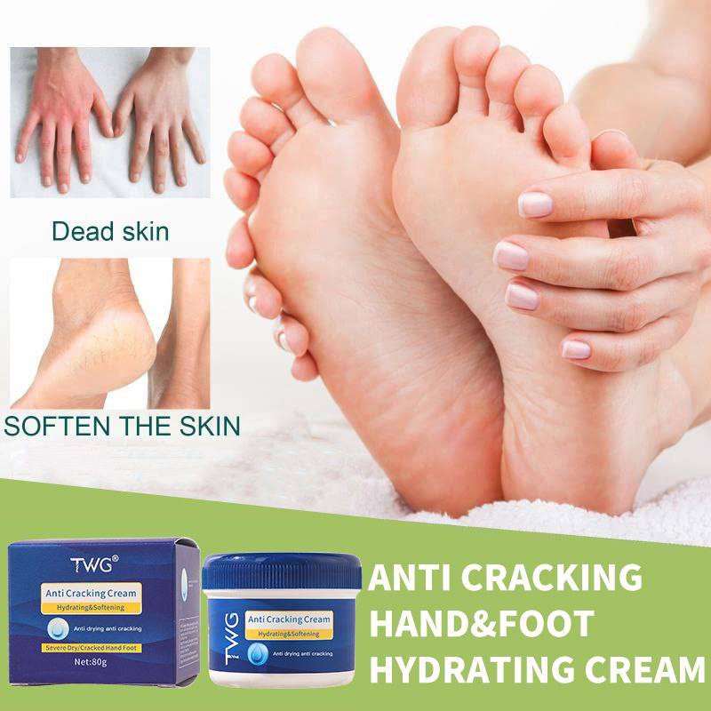 TWG كريم العناية ومقاومة تشقق اليدين والقدمين 80 غرام